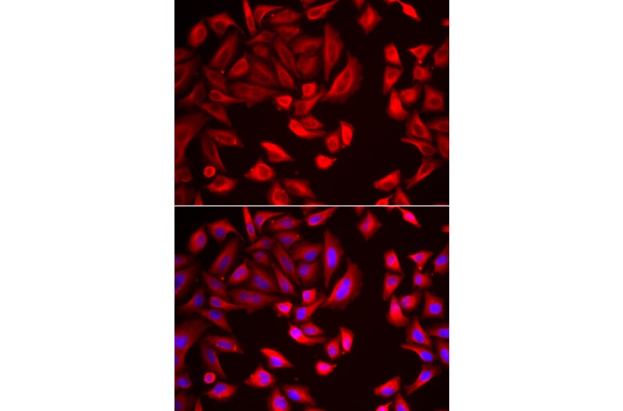 Immunofluorescence - Anti-CCT2 Antibody (A15271) - Antibodies.com