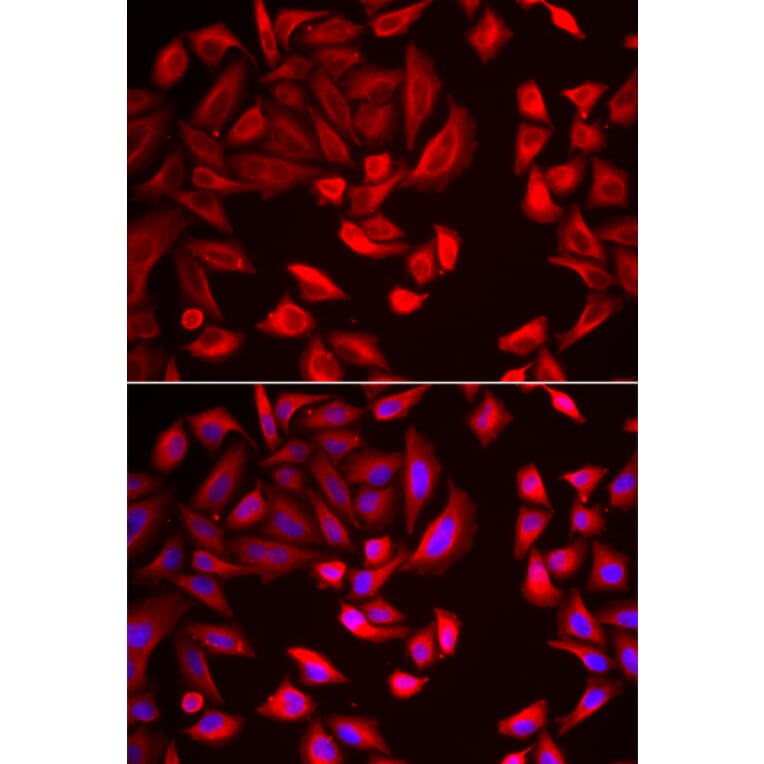 Immunofluorescence - Anti-CCT2 Antibody (A15271) - Antibodies.com