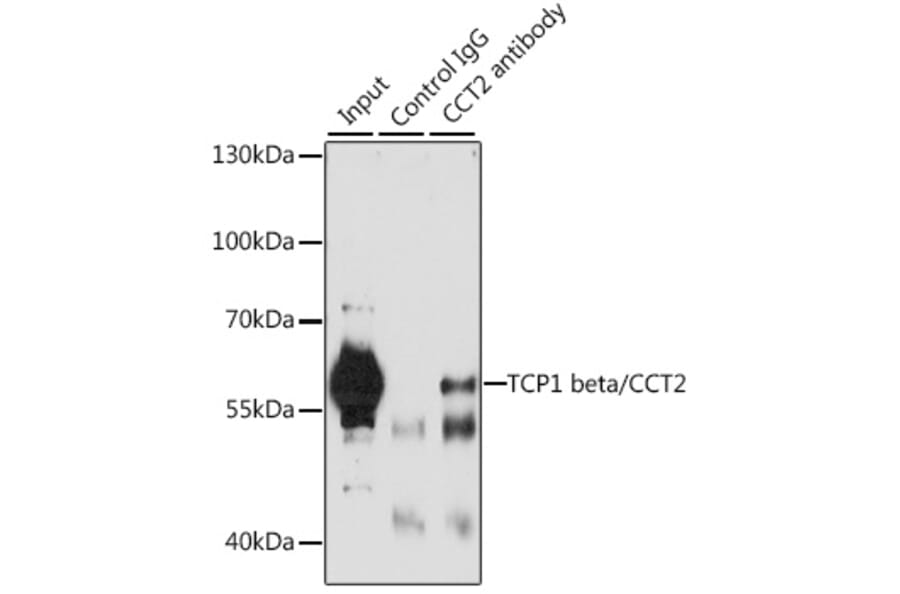 Immunoprecipitation - Anti-CCT2 Antibody (A15271) - Antibodies.com