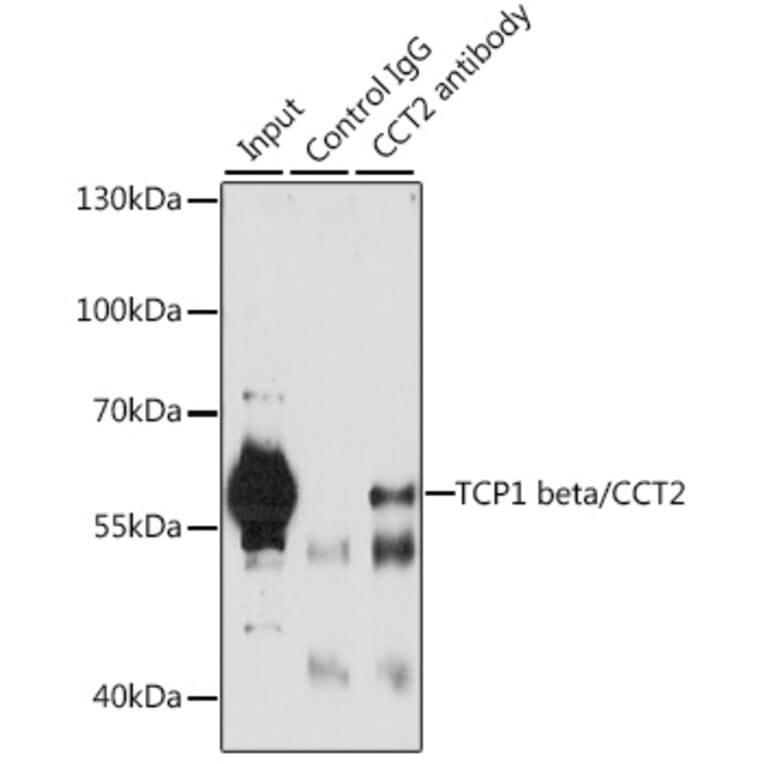 Immunoprecipitation - Anti-CCT2 Antibody (A15271) - Antibodies.com