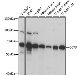 Western Blot - Anti-CCT3 Antibody (A15272) - Antibodies.com