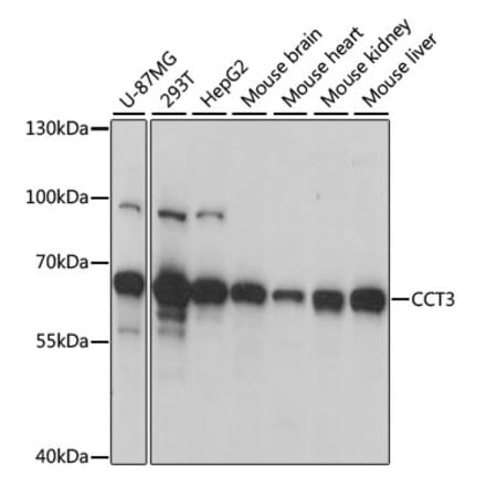 Western Blot - Anti-CCT3 Antibody (A15272) - Antibodies.com