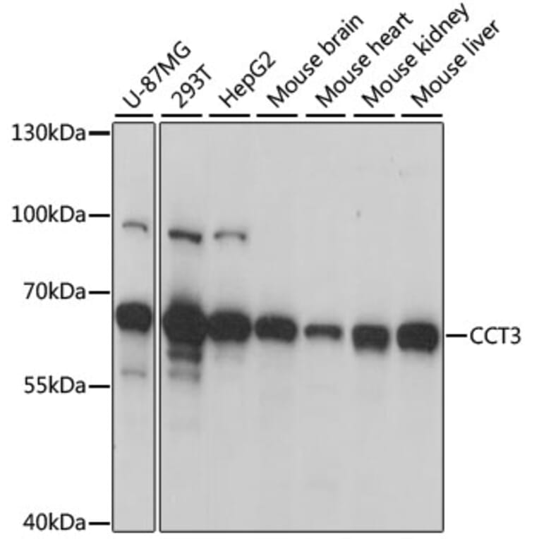 Western Blot - Anti-CCT3 Antibody (A15272) - Antibodies.com