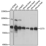 Western Blot - Anti-CCT3 Antibody (A15272) - Antibodies.com