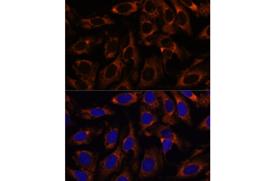 Immunofluorescence - Anti-CCT3 Antibody (A15272) - Antibodies.com
