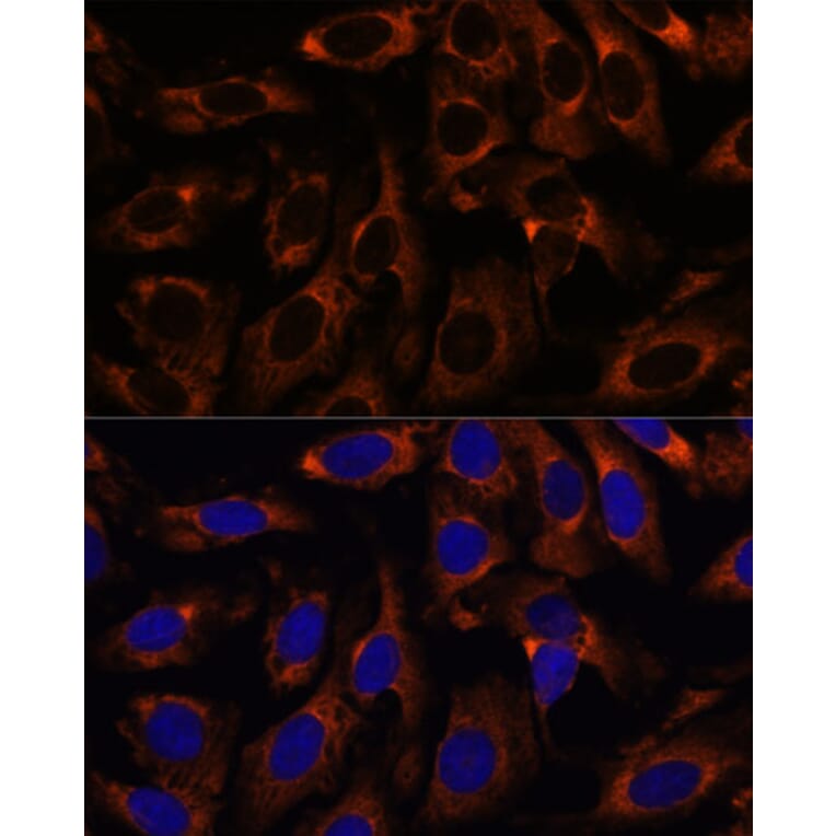 Immunofluorescence - Anti-CCT3 Antibody (A15272) - Antibodies.com