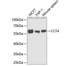 Western Blot - Anti-TCP1 delta Antibody (A15273) - Antibodies.com