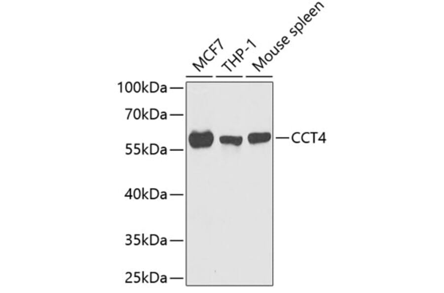 Western Blot - Anti-TCP1 delta Antibody (A15273) - Antibodies.com