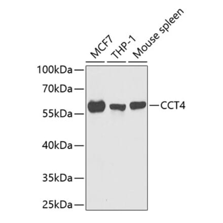 Western Blot - Anti-TCP1 delta Antibody (A15273) - Antibodies.com