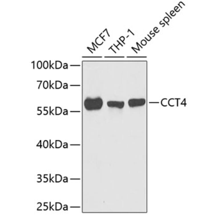 Western Blot - Anti-TCP1 delta Antibody (A15273) - Antibodies.com