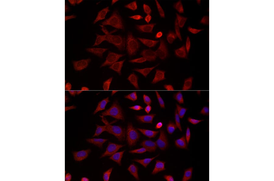 Immunofluorescence - Anti-TCP1 delta Antibody (A15273) - Antibodies.com