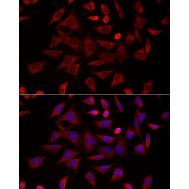 Immunofluorescence - Anti-TCP1 delta Antibody (A15273) - Antibodies.com