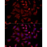Immunofluorescence - Anti-TCP1 delta Antibody (A15273) - Antibodies.com