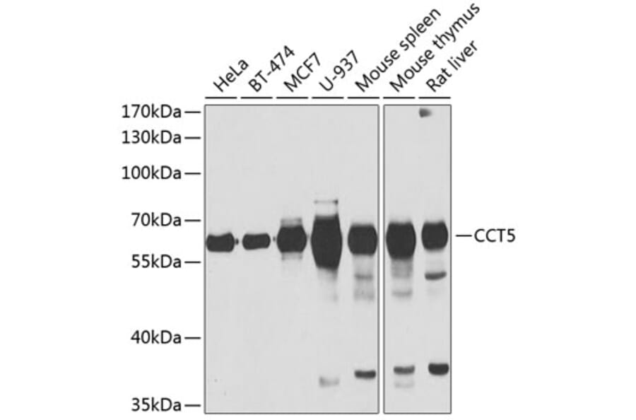 Western Blot - Anti-TCP1 epsilon/CCT5 Antibody (A15274) - Antibodies.com