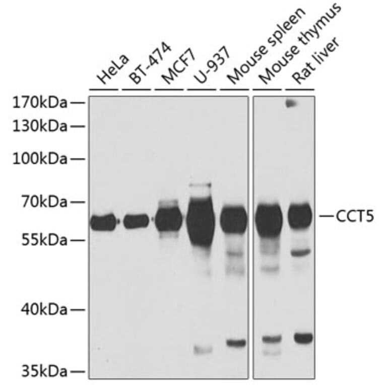 Western Blot - Anti-TCP1 epsilon/CCT5 Antibody (A15274) - Antibodies.com