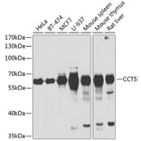 Western Blot - Anti-TCP1 epsilon/CCT5 Antibody (A15274) - Antibodies.com