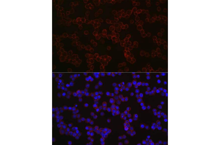 Immunofluorescence - Anti-CD68 Antibody (A15276) - Antibodies.com