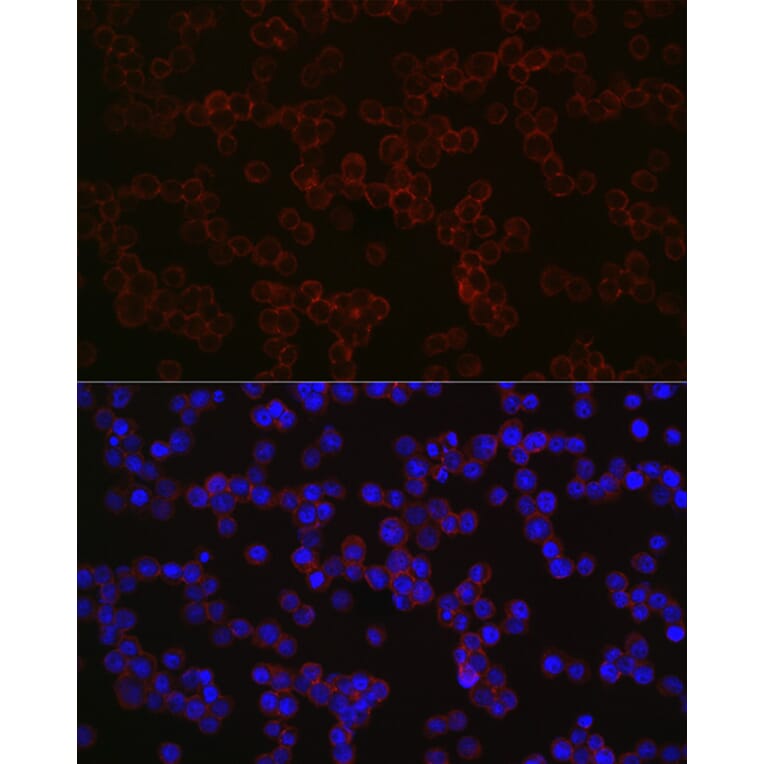 Immunofluorescence - Anti-CD68 Antibody (A15276) - Antibodies.com