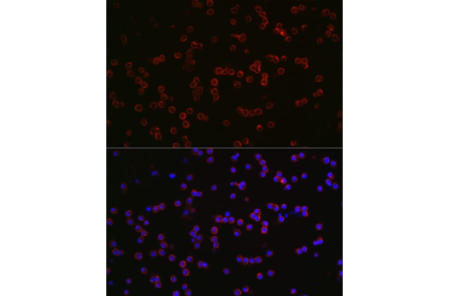 Immunofluorescence - Anti-CD68 Antibody (A15276) - Antibodies.com
