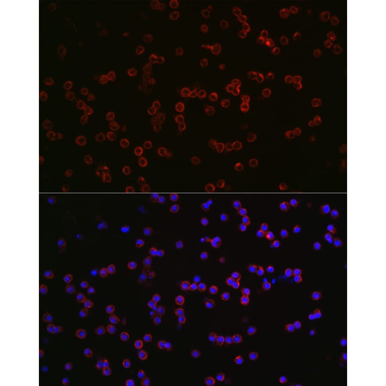 Immunofluorescence - Anti-CD68 Antibody (A15276) - Antibodies.com