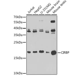 Western Blot - Anti-CIRP Antibody (A15277) - Antibodies.com