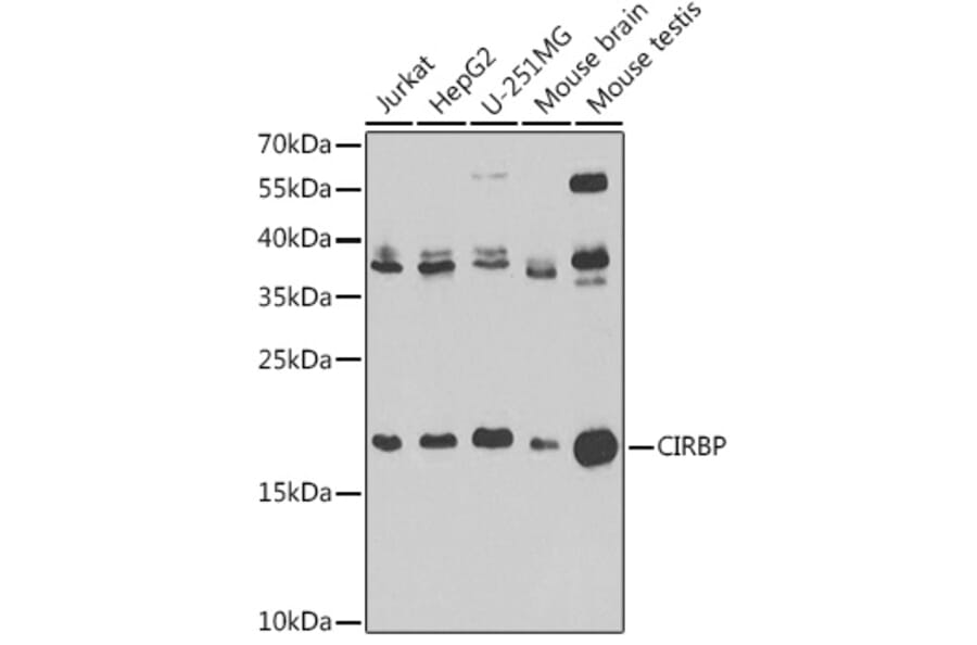 Western Blot - Anti-CIRP Antibody (A15277) - Antibodies.com