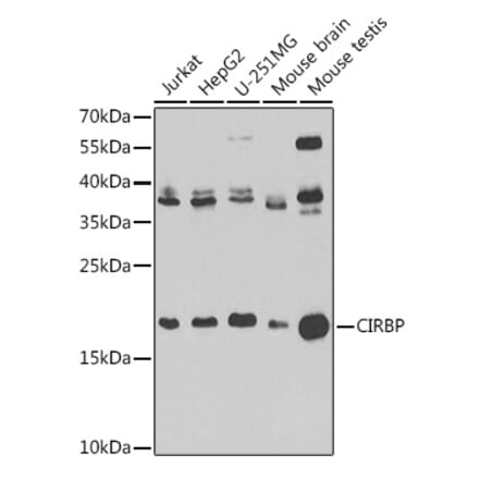Western Blot - Anti-CIRP Antibody (A15277) - Antibodies.com