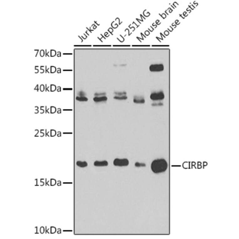 Western Blot - Anti-CIRP Antibody (A15277) - Antibodies.com