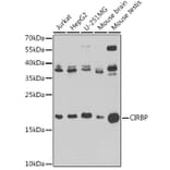 Western Blot - Anti-CIRP Antibody (A15277) - Antibodies.com