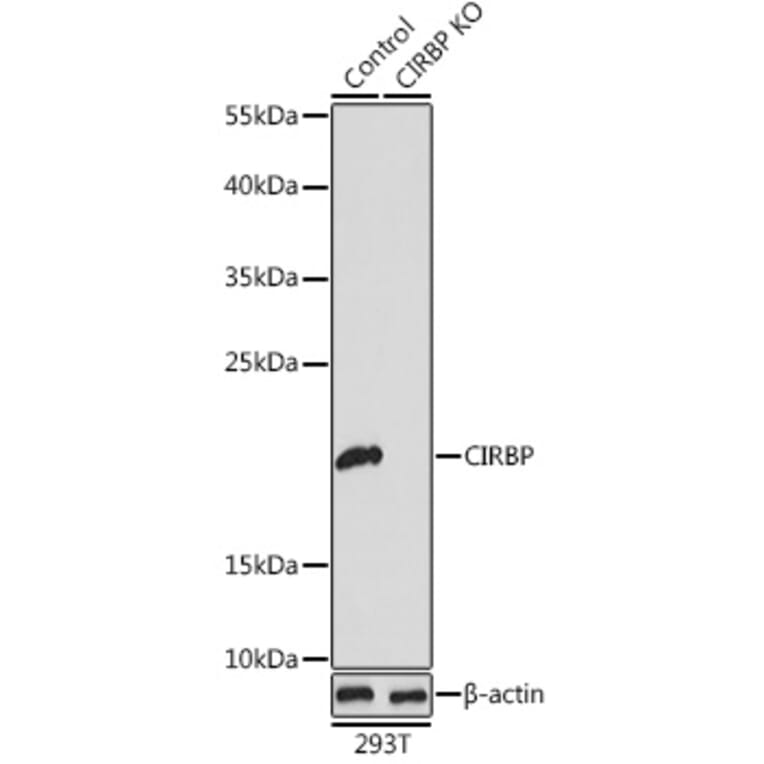 Western Blot - Anti-CIRP Antibody (A15277) - Antibodies.com