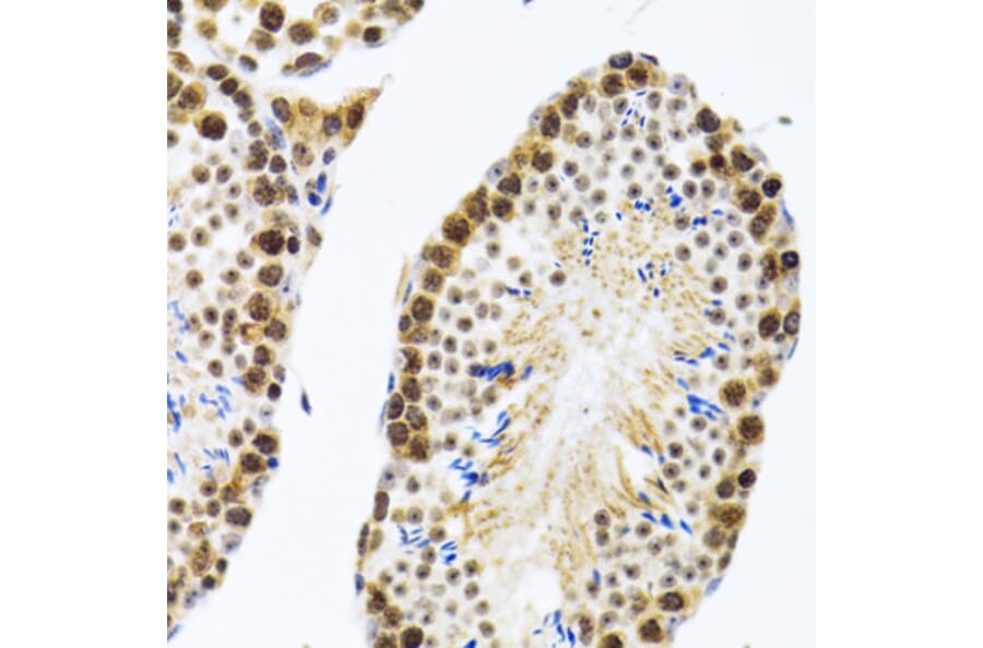 Immunohistochemistry - Anti-CIRP Antibody (A15277) - Antibodies.com