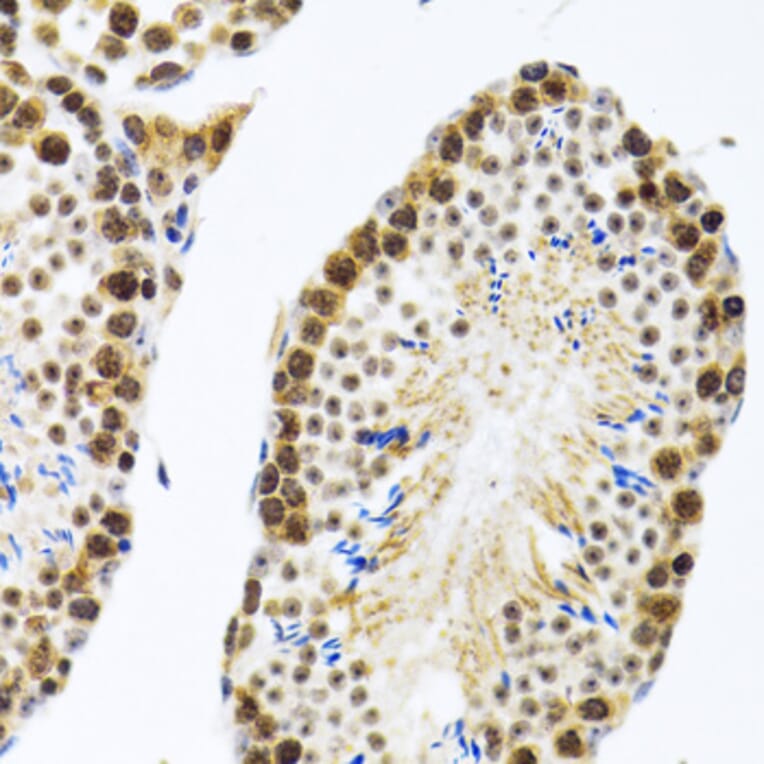 Immunohistochemistry - Anti-CIRP Antibody (A15277) - Antibodies.com