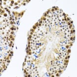 Immunohistochemistry - Anti-CIRP Antibody (A15277) - Antibodies.com