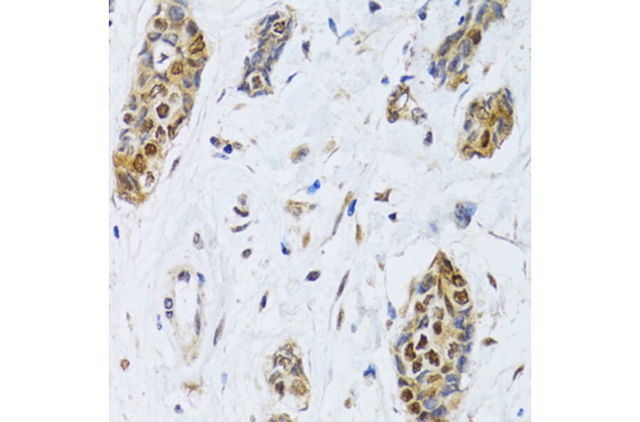 Immunohistochemistry - Anti-CIRP Antibody (A15277) - Antibodies.com