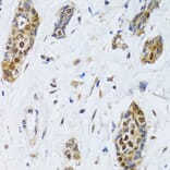 Immunohistochemistry - Anti-CIRP Antibody (A15277) - Antibodies.com