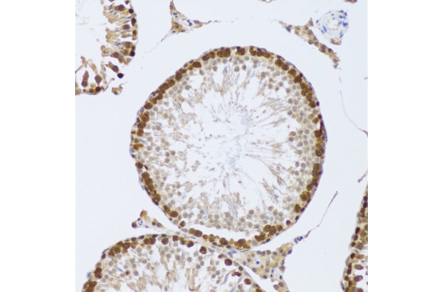 Immunohistochemistry - Anti-CIRP Antibody (A15277) - Antibodies.com