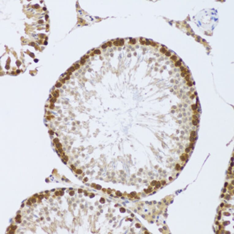 Immunohistochemistry - Anti-CIRP Antibody (A15277) - Antibodies.com