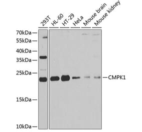 Western Blot - Anti-Nucleoside-diphosphate kinase Antibody (A15278) - Antibodies.com