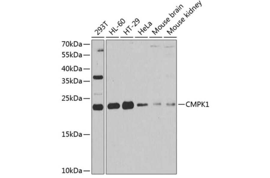 Western Blot - Anti-Nucleoside-diphosphate kinase Antibody (A15278) - Antibodies.com