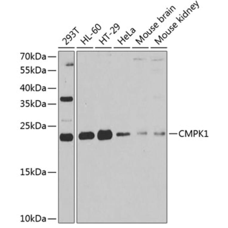 Western Blot - Anti-Nucleoside-diphosphate kinase Antibody (A15278) - Antibodies.com