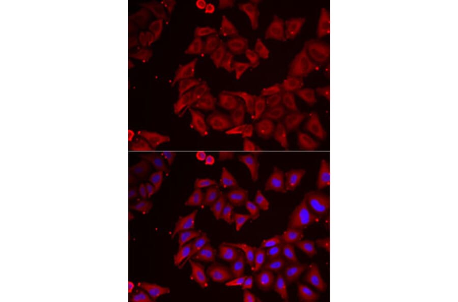 Immunofluorescence - Anti-Nucleoside-diphosphate kinase Antibody (A15278) - Antibodies.com