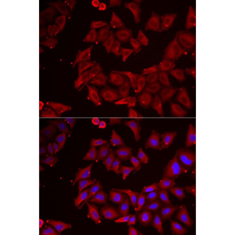 Immunofluorescence - Anti-Nucleoside-diphosphate kinase Antibody (A15278) - Antibodies.com