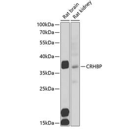 Western Blot - Anti-CRHBP Antibody (A15279) - Antibodies.com