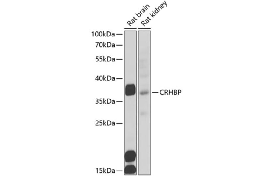 Western Blot - Anti-CRHBP Antibody (A15279) - Antibodies.com