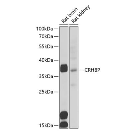 Western Blot - Anti-CRHBP Antibody (A15279) - Antibodies.com