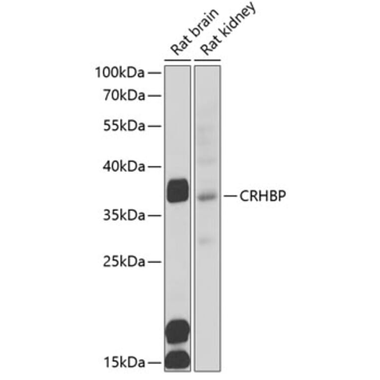 Western Blot - Anti-CRHBP Antibody (A15279) - Antibodies.com