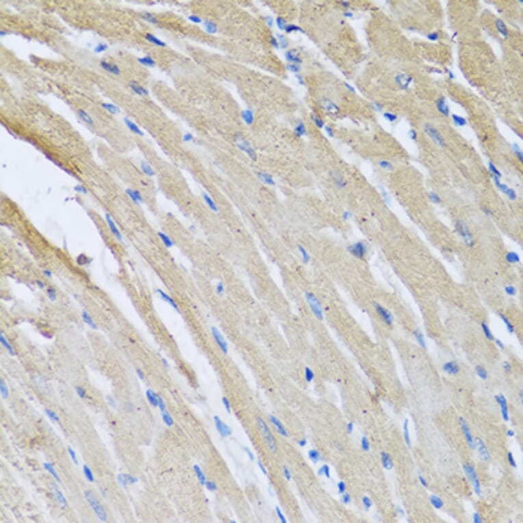 Immunohistochemistry - Anti-CRHBP Antibody (A15279) - Antibodies.com
