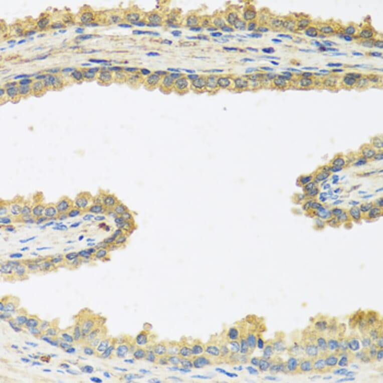 Immunohistochemistry - Anti-CRHBP Antibody (A15279) - Antibodies.com