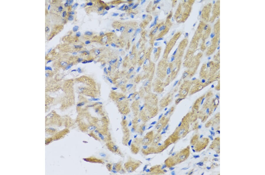 Immunohistochemistry - Anti-CRHBP Antibody (A15279) - Antibodies.com