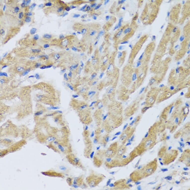 Immunohistochemistry - Anti-CRHBP Antibody (A15279) - Antibodies.com